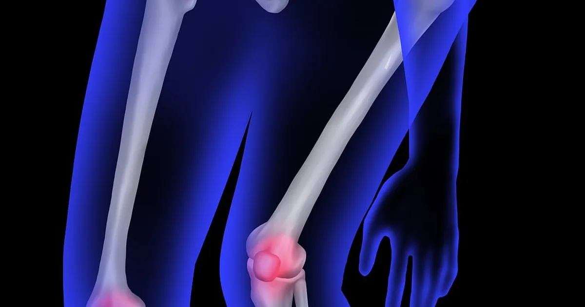 Glucosamine or Collagen: Understanding Their Impact on Knee Pain